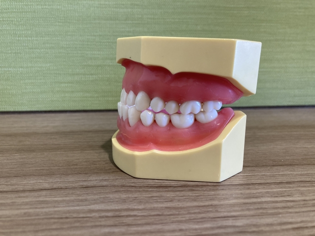 受け口の模型