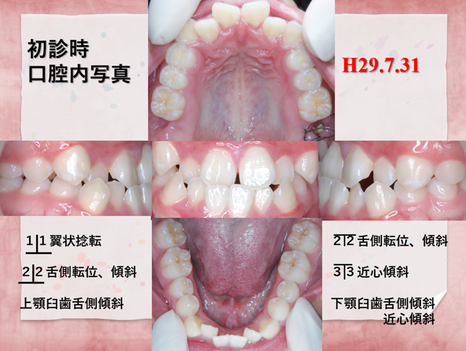 19歳女性前
