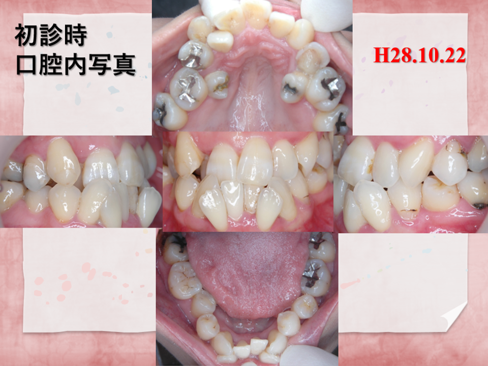 39歳女性前