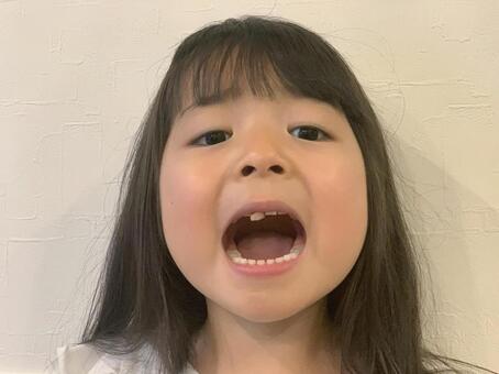 子供のMFT矯正